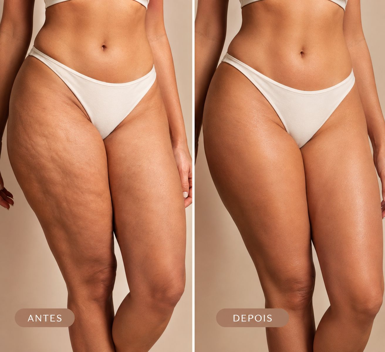 Antes e depois do uso do Sanctus BumBum Pró — pele mais lisa e uniforme